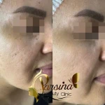 کلینیک زیبایی پارسینا