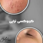 تصویر خدمات فوق تخصصی پوست مژگان صالحی