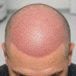 لوگوی کلینیک فوق تخصصی پوست و مو و لاغری بنیتا