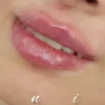 کلینیک زیبایی حانیمو