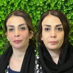 مرکز لیزر و کلینیک زیبایی سورا