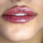 کلینیک لیزر پوست و مو زیبایی توکا