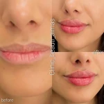 کلینیک زیبایی الماس