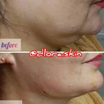 مرکز لیزر و کلینیک زیبایی دلارا