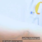 لیزر،پوست،مو(منطقه ۷ تهران)دکتر محمودی