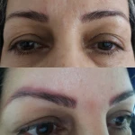 مطب پوست ،مو زیبایی دکتر فاطمه قره داغی