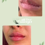 کلینیک زیبایی درموگه