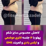 مرکز لاغری موضعی و ایکس بادی فیت اسمارت