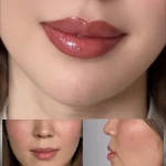 تصویر کلینیک زیبایی  و لاغری تخصصی میرای
