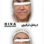 کلنیک پوست مو زیبای لیزر هیوا