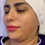 خدمات فوق تخصصی پوست مژگان صالحی