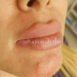 دکتر محمد امید بهترین دکتر زیبایی کانتور