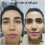کلینیک زیبایی و لیزر مو گندم