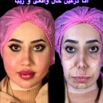 کلینیک زیبایی و مرکز لیزر و هایفو مرکز دلورا