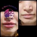 مطب زیبایی دکتر مینو شعبانی