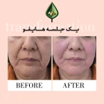 کلینیک زیبایی و مرکز لیزر آیه نقی زاده