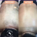 مرکز لیزر و پاکسازی پوست سحر