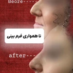 نمونه کار مرکز لیزر کلینیک زیبایی رزنیلای مرزداران