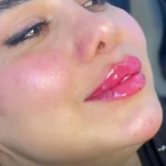  کلینیک پوست و زیبایی شایلی
