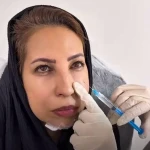 کلینیک پوست مو زیبایی زیما