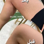 تصویر مرکز لیزر و کلینیک زیبایی پارسا