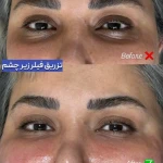 تصویر کلینیک زیبایی بلا