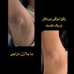 مرکزتخصصی کراتین تهرانپارس