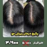 کلینیک آیریس