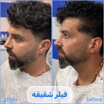 تصویر برفین اسکین