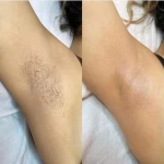 نمونه کار کلینیک لیزر و زیبایی دکتر احمدی