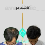 تصویر کلینیک تخصصی پوست و کاشت مو آوا