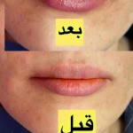 کلینیک زیبایی دکتر پوروزیری