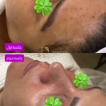 مرکز حرفه ای پوست و مو بهناز دست ورز