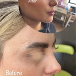 نمونه کار کلینیک زیبایی دکتر الهه کریمی