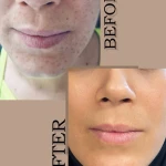 کلینیک زیبایی درناز (تخفیف ویژه لیزر)