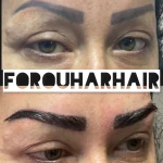 تصویر کلینیک تخصصی کاشت مو و ابروی فروهر