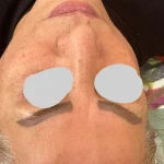 تصویر پاکسازی و جوانسازی پوست سمیرا صادقی