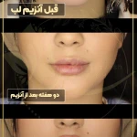 مرکز لیزر و کلینیک زیبایی و بوتاکس ستایش