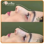 مرکز زیبایی درنیکا