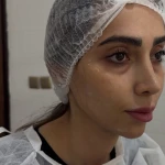 نمونه کار کلینیک زیبایی رز-دکتر رضوان موسوی