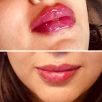 نمونه کار کلینیک زیبایی هونورا