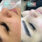 خدمات تخصصی پاکسازی پوست ساجده عنایتی