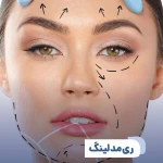 کلینیک زیبایی و لاغری بلو بیوتی رویال