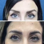 نمونه کار کلینیک  پوست مو زیبایی و لیزر ویان