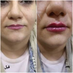 کلینیک زیبایی و لیزر مو گندم