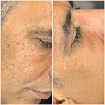 کلینیک زیبایی پارسینا