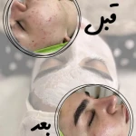 سالن زیبایی اکستنشن شرق - زیبایی طبیعی