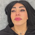 نمونه کار کلینیک پوست مو و زیبایی دکتر زلفی