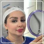 مرکز کاشت مو و ابرو فیشال cip