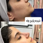 فیشال تخصصی  سعیده صدیقی